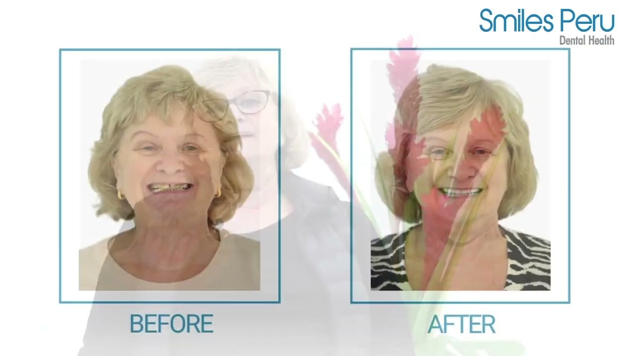 Oral Rehabilitation at Smiles Peru