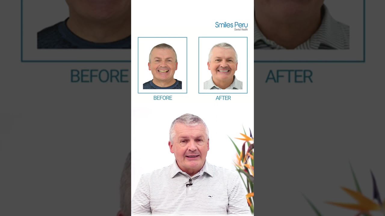 "They worked Magic" | Robert Middleton solved a complex dental issue in Peru 🇺🇸✨