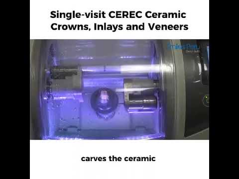 CEREC Technology | Single-Visit Smile Restorations