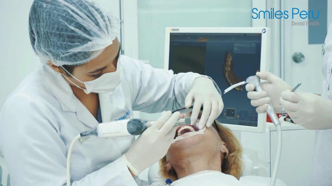 Porcelain Veneers | Smiles Peru | Carillas de Porcelana