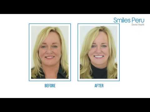 Smiles Peru Dental Tourism Lima