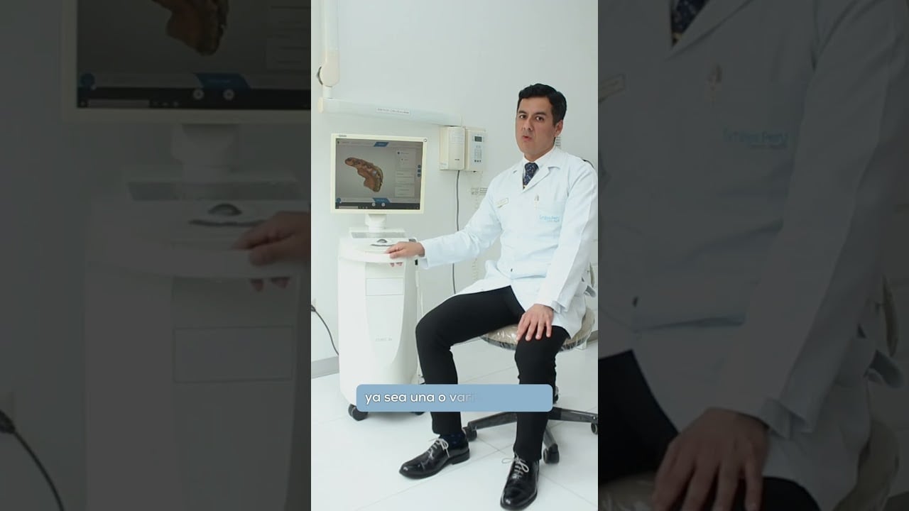 Ventajas del CEREC | Smiles Peru