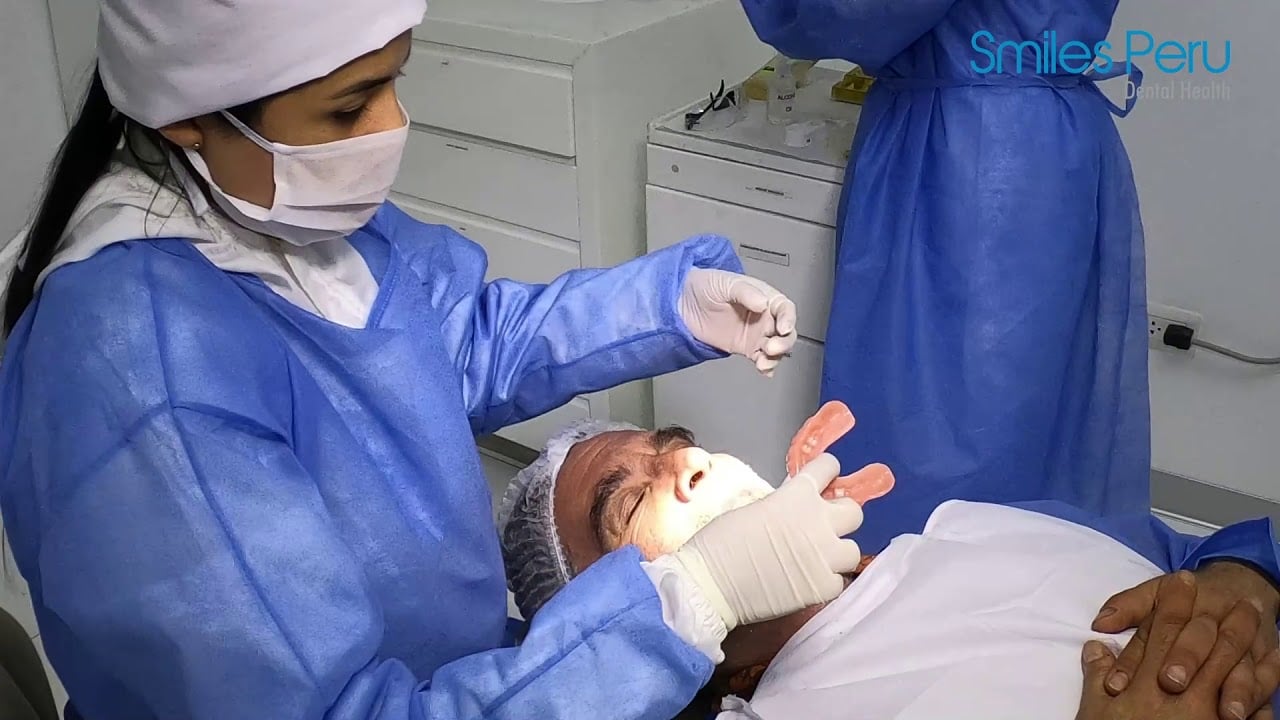 Smiles Peru: Implant Supported Removable Prosthesis