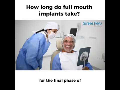 How Long Do Full Mouth Implants Take? | Smiles Peru