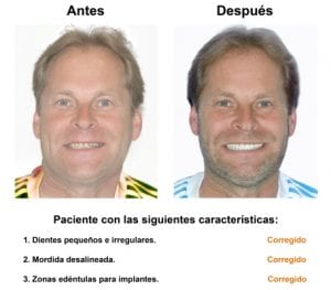 Smiles-Peru-Rehabilitacion-Oral-Caso-Clinico-1-300x263