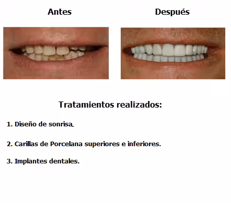 john-case-study-slide3-EN-v1-02