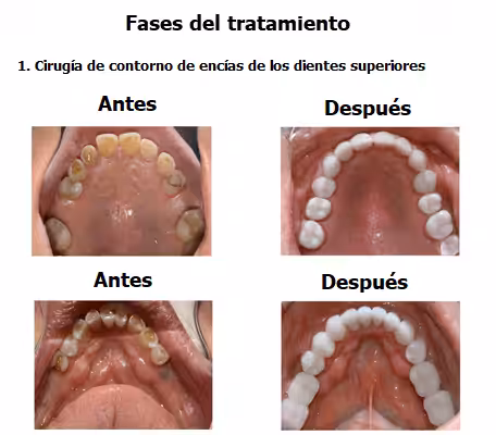 john-case-study-slide5-EN-v1-02