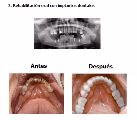 john-case-study-slide6-EN-v1-02
