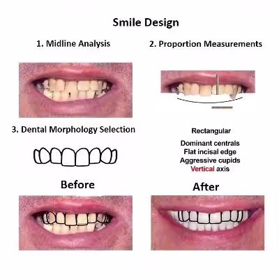 Smiles Peru Oral Rehabilitation (2) Smiles Peru Oral Rehabilitation (2)