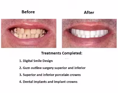 Smiles Peru Oral Rehabilitation (3) Smiles Peru Oral Rehabilitation (3)