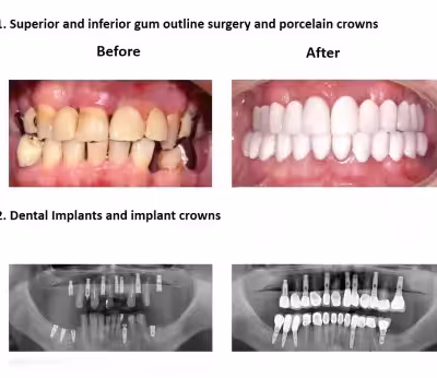Smiles Peru Oral Rehabilitation (4) Smiles Peru Oral Rehabilitation (4)