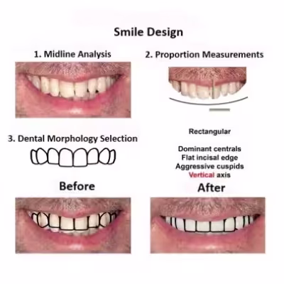 Digital-Smile-Design-Smiles-Peru-2