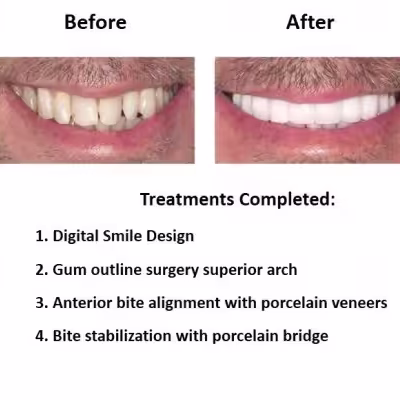 Digital-Smile-Design-Smiles-Peru-3