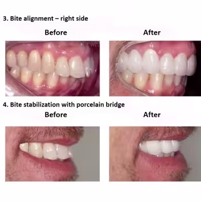 Digital-Smile-Design-Smiles-Peru-5