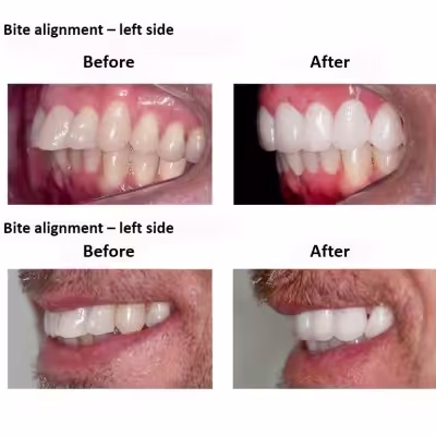 Digital-Smile-Design-Smiles-Peru-6