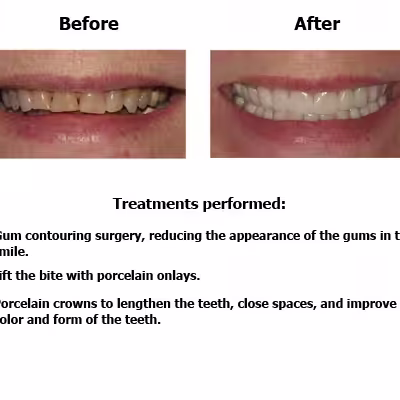 Linda-case-study-slide3-EN-v1