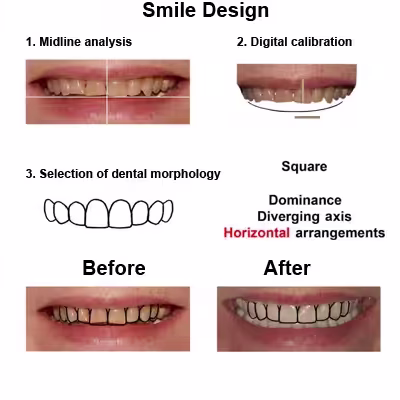 Linda-case-study-slide4-EN-v1