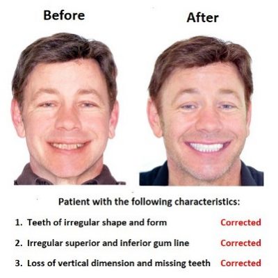 Oral-Rehabilitation-Smiles-Peru-Case-Study