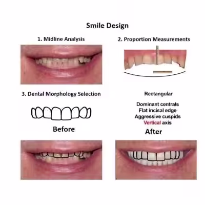 Oral-Rehabilitation-Smiles-Peru-Case-Study