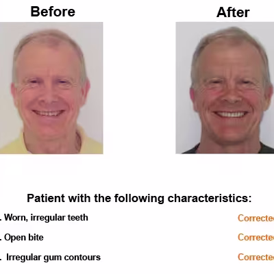 Randel-case-study-slide2-EN-v1