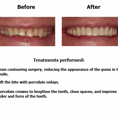 Randel-case-study-slide3-EN-v1