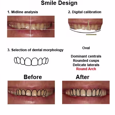 Randel-case-study-slide4-EN-v1