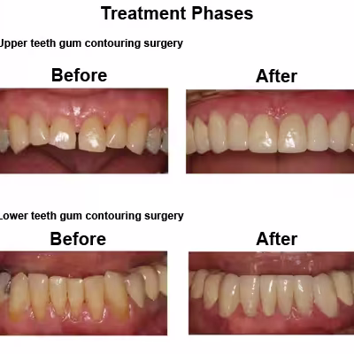 Randel-case-study-slide5-EN-v1