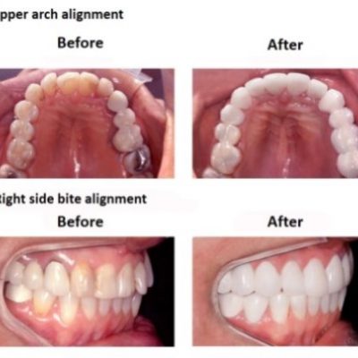 Smile-Design-Lima-Dentist-Smiles-Peru-5