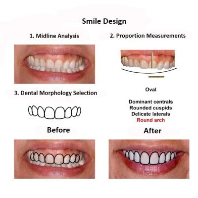 Smile-Design-Smiles-Peru-Case-Study