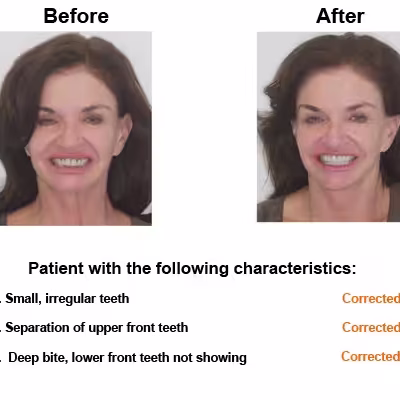 Susan-case-study-slide2-EN-v1 Susan-case-study-slide2-EN-v1