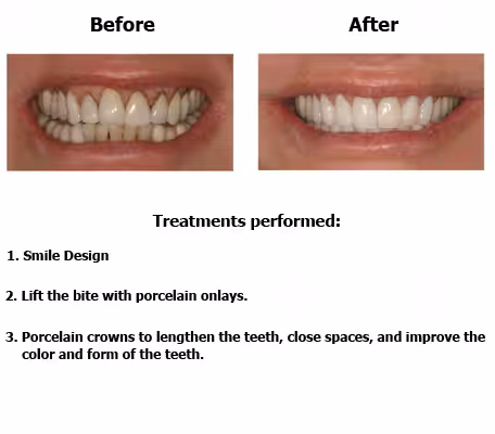 Susan-case-study-slide3-EN-v1