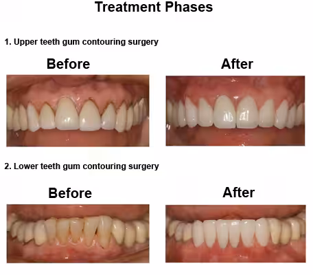 Susan-case-study-slide5-EN-v1