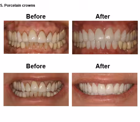Susan-case-study-slide8-EN-v1