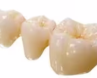 dental bridge smiles peru