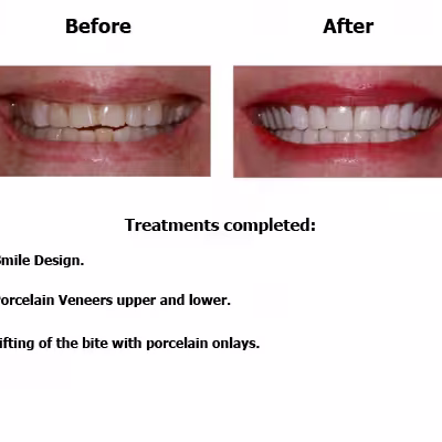june-case-study-slide3-EN-v1