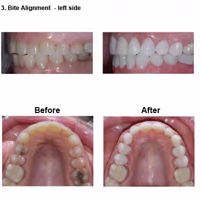 june-case-study-slide6-EN-v1