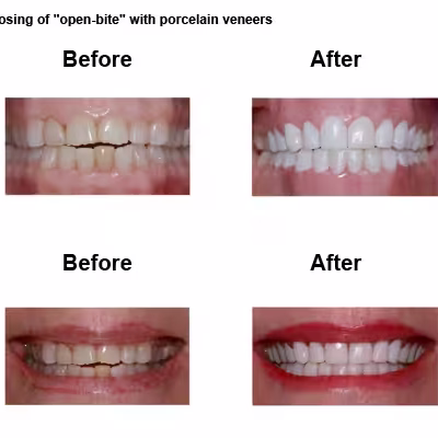 june-case-study-slide8-EN-v1