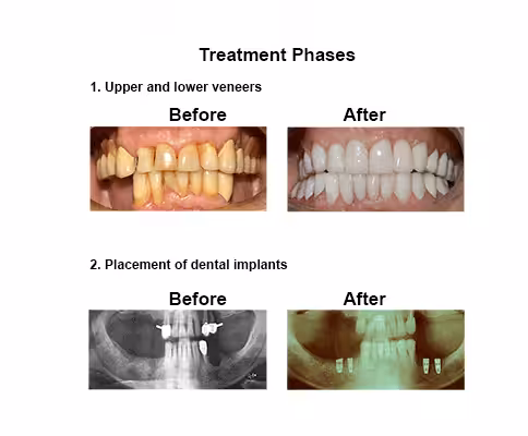 mauro-case-study-slide4-en