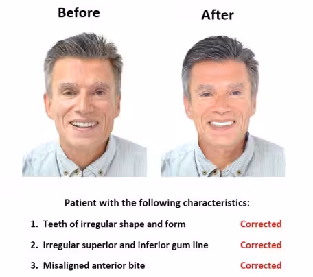 oral-rehabilitation-smiles-peru-case-study-john-1-3 cad cam smiles peru