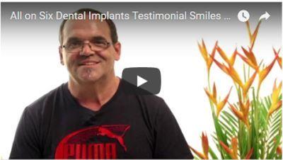 Manuel All-on-Six Dental Implants Testimonial Smiles Peru