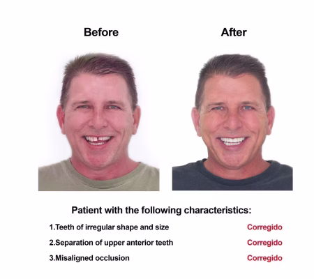 Cosmetic Dentistry and Rehabilitation Smiles Peru (1)