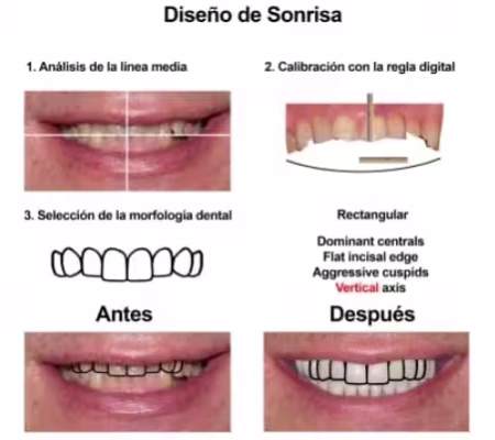 Rehabilitacion Oral e implantes dentales Smiles Peru (2) Rehabilitacion Oral e implantes dentales Smiles Peru (2)