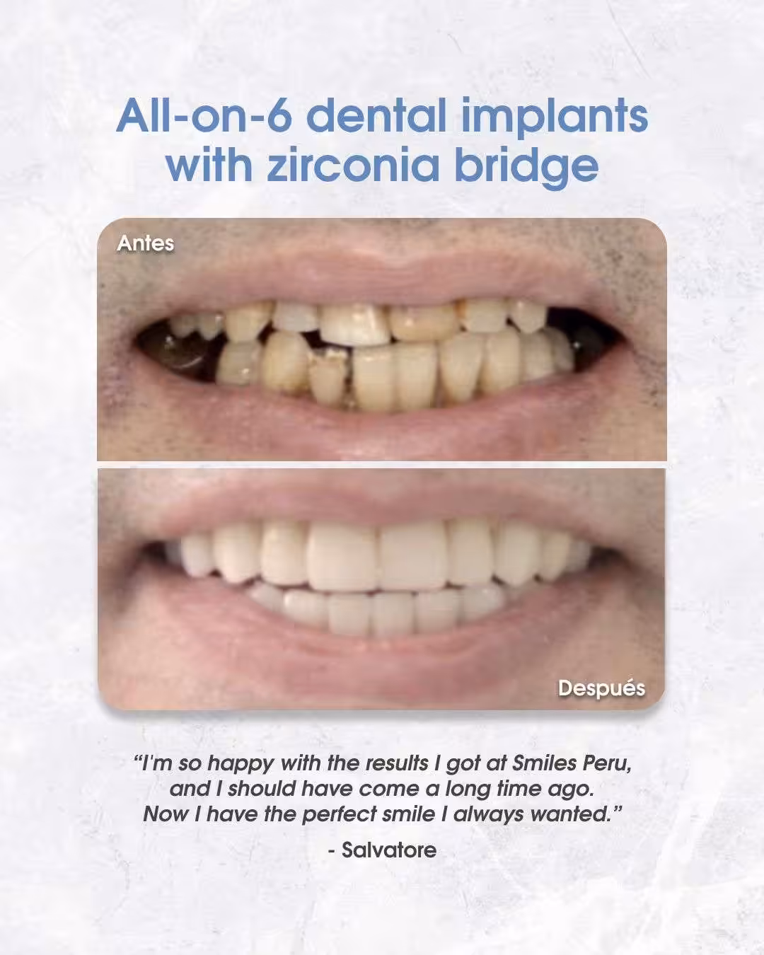 Before and after dental implants with zirconia bridge
