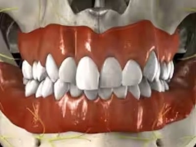 Asimetría mandibular - Cirugía Ortognática Smiles Peru